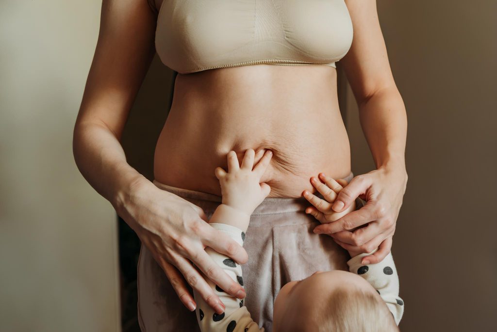 Addome di una mamma dopo il parto con le mani del suo bambino