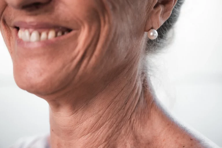 Volto sorridente: pre e post menopausa